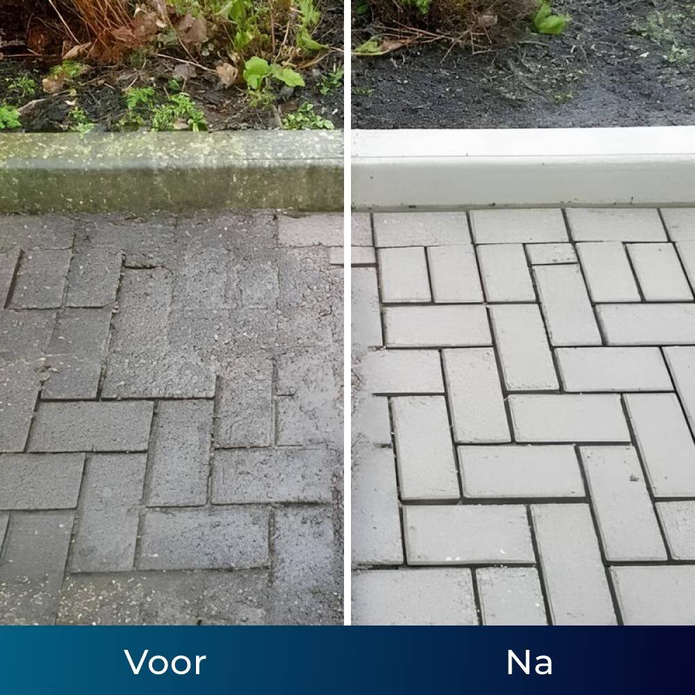 NuraFix image